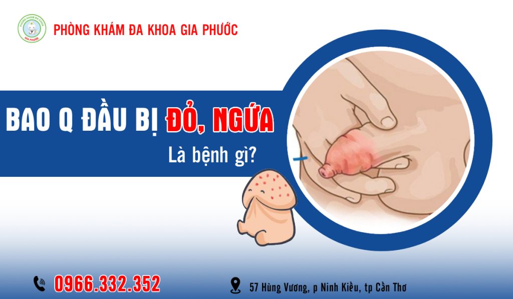 Tình trạng bao quy đầu bị đỏ và ngứa bệnh gì?
