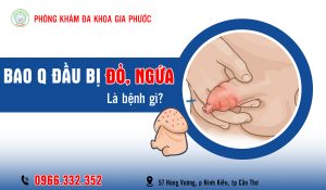 Tình trạng bao quy đầu bị đỏ và ngứa bệnh gì?