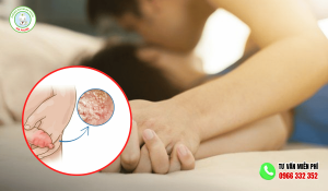Viêm Bao Quy Đầu Quan Hệ Có Sao Không
