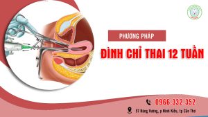 12 tuần phá thai được không?