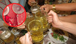Bệnh Trĩ Có Uống Bia Được Không