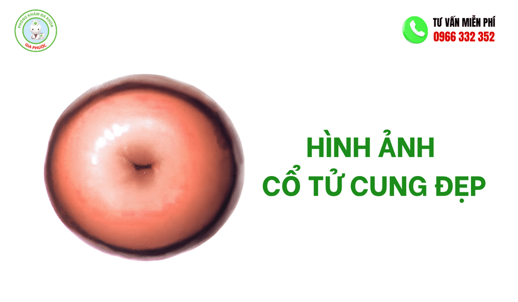 Hình Ảnh Cổ Tử Cung Đẹp