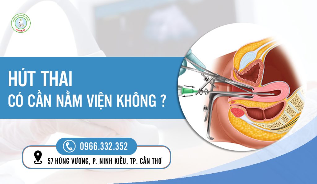 Hút Thai Có Nằm Viện Không? Thời Gian Theo Dõi & Hồi Phục Chuẩn Y Khoa 1 Hút thai có nằm viện không?