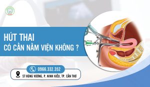 Hút thai có nằm viện không?